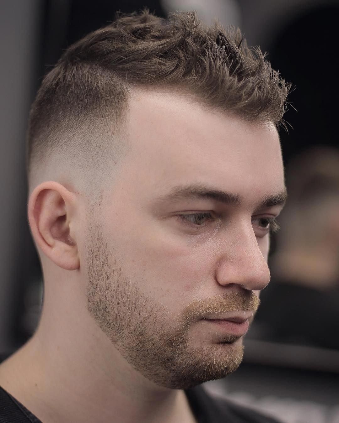 Receding Hairline