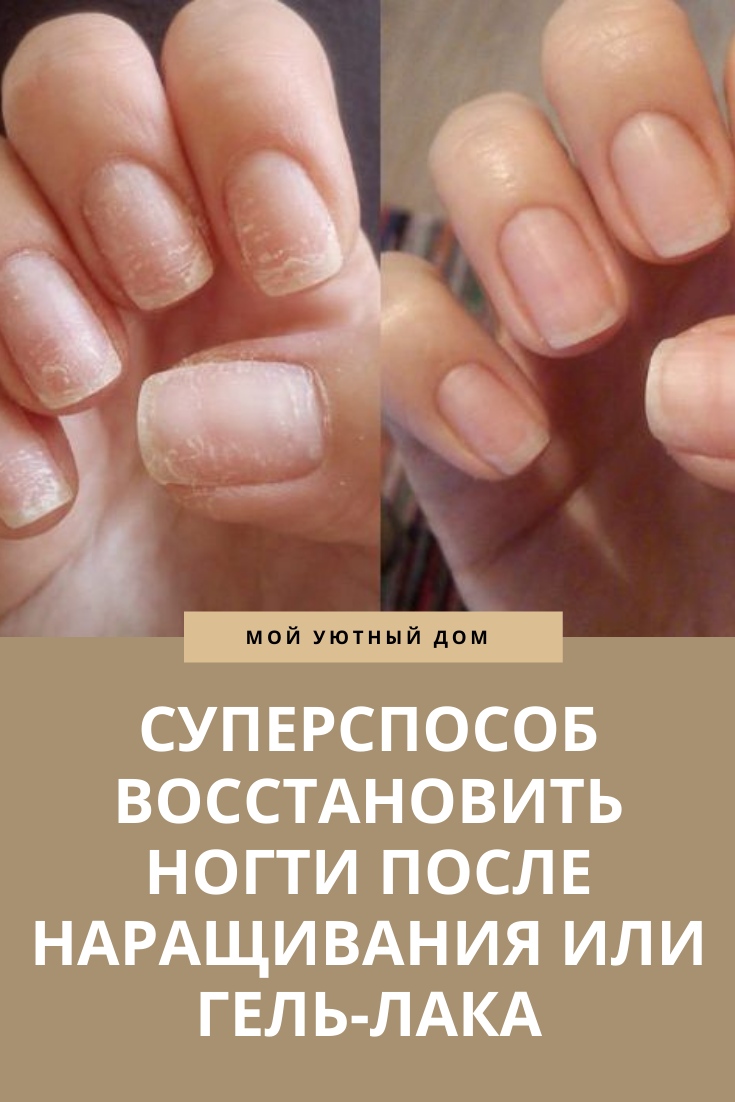 Восстановление ногтей после наращивания