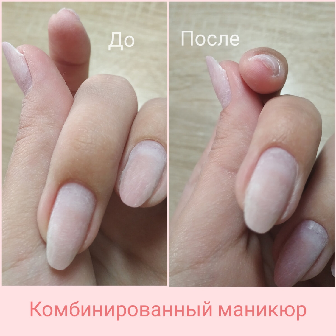 Пропилы на ногтях после аппаратного маникюра