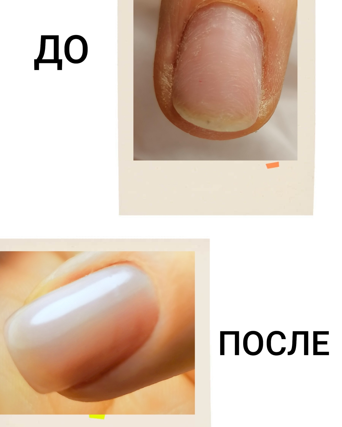 Формы ногтей и название