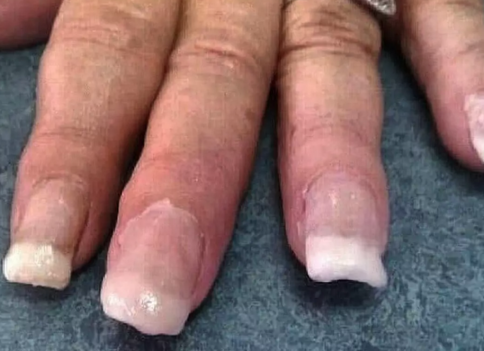 Неудачный маникюр гель лаком