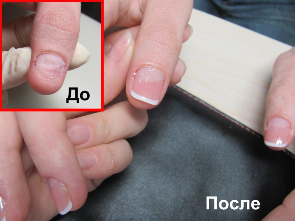 Девушка кусает ногти