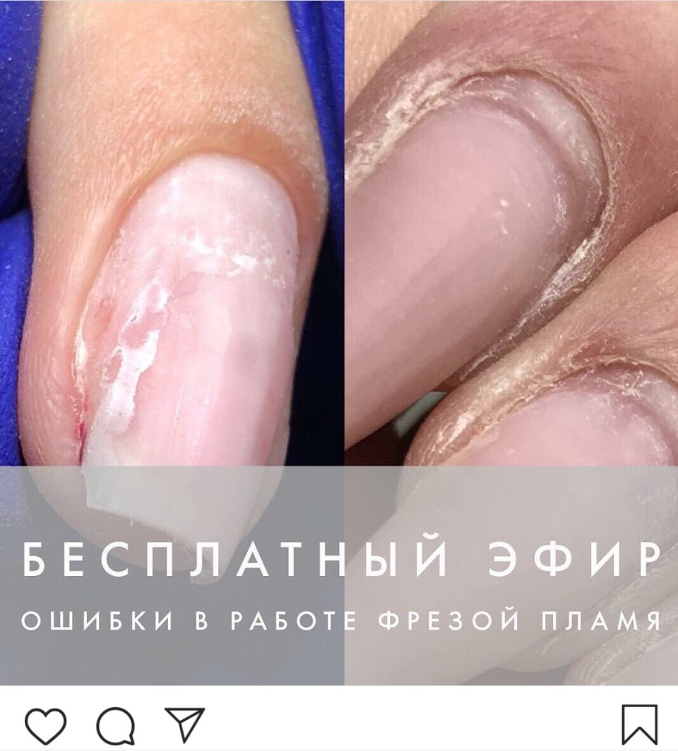 Ямы на ногтях после аппаратного маникюра