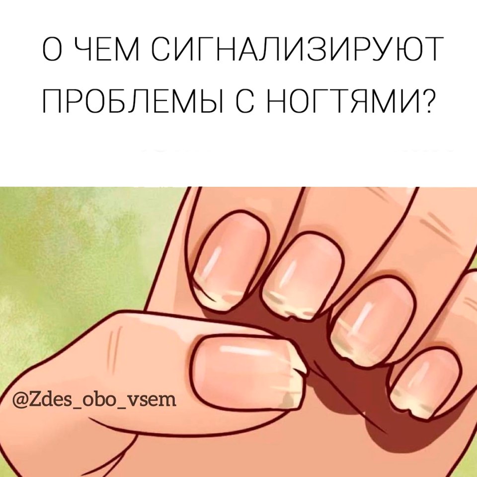 Всегда ногти