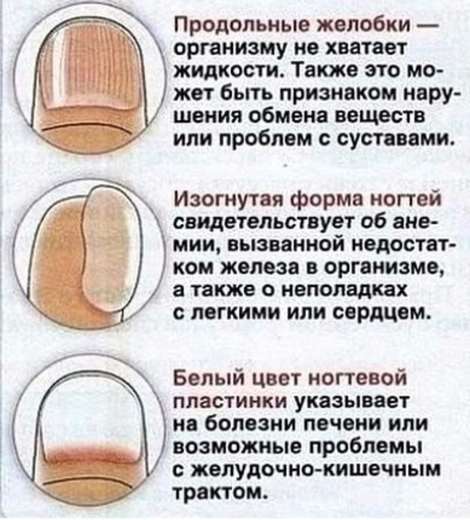 Определить болезнь по ногтям