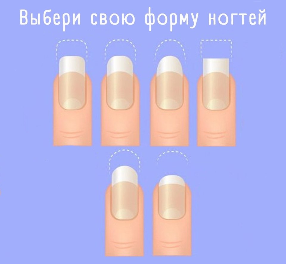Ногти с коротким ногтевым ложем