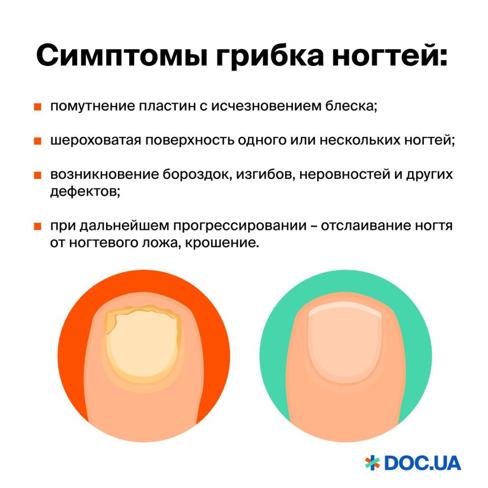 Квадратная форма ногтей без лака