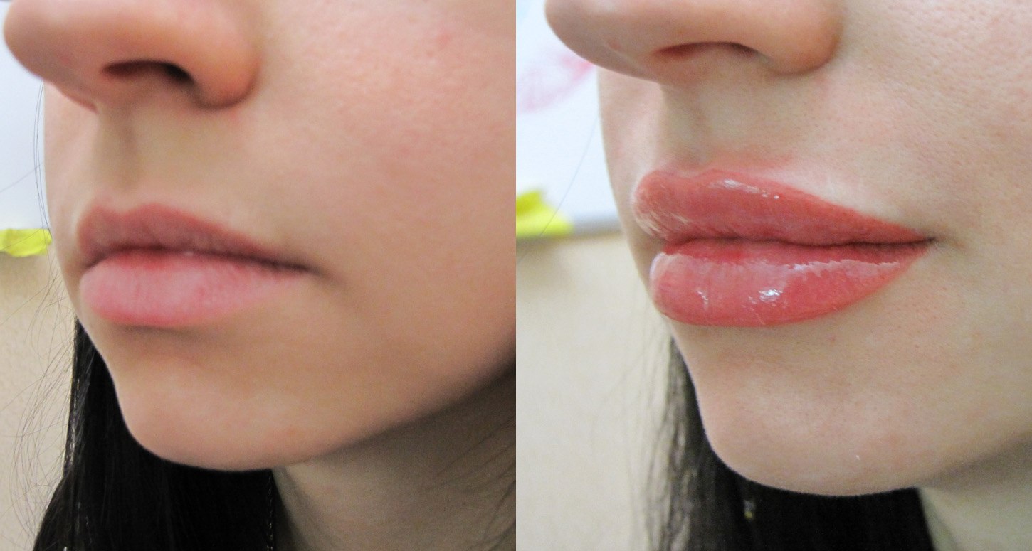 Когда можно целоваться после губ. Татуаж губ. Перманентный макияж губ. Зажившие губы после перманентного макияжа. Перманент губ до и после.