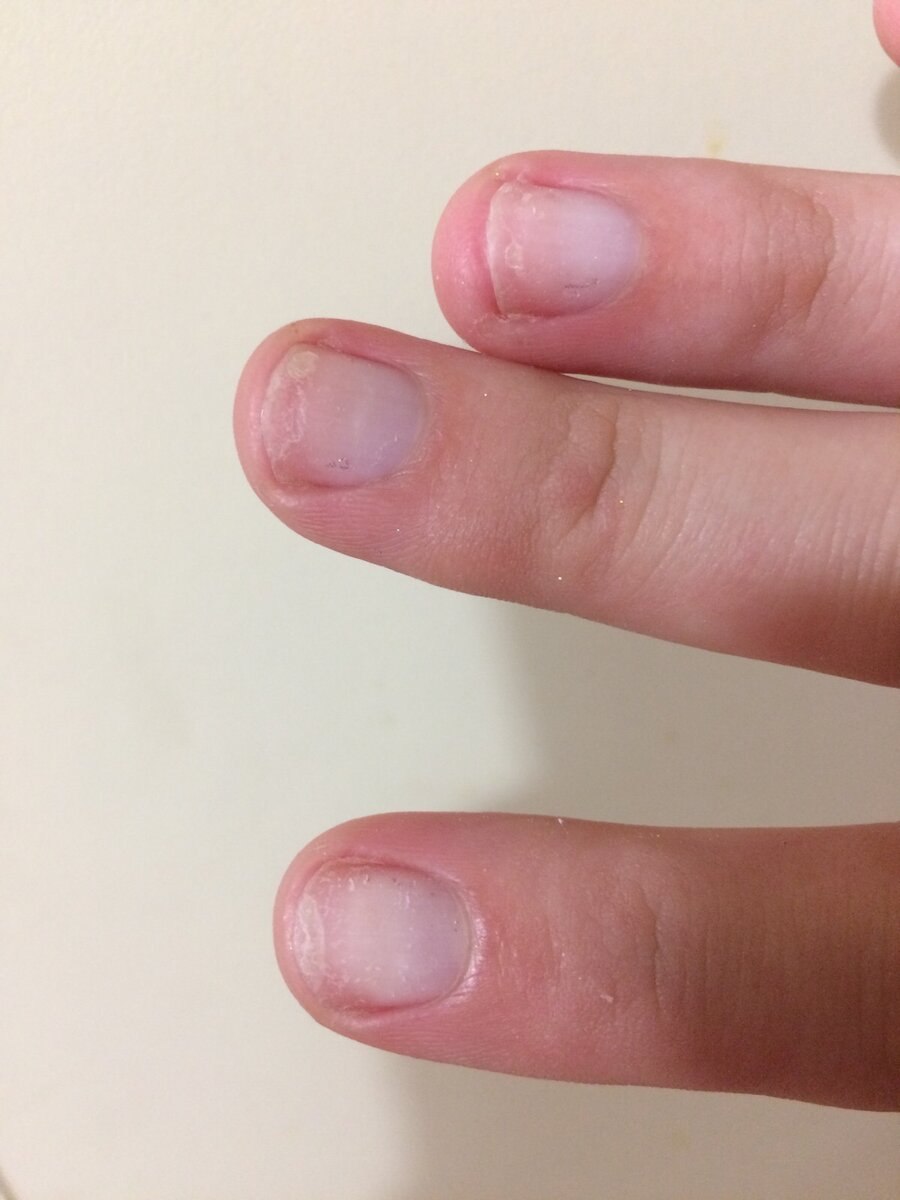 Ногти после геля стали тонкие. Тонкие ногти.