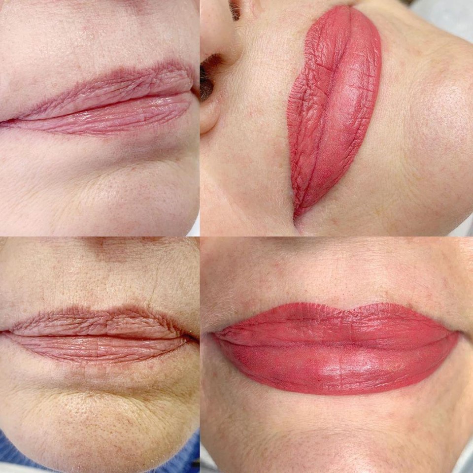 Перманентный макияж губ фото после заживления таблица