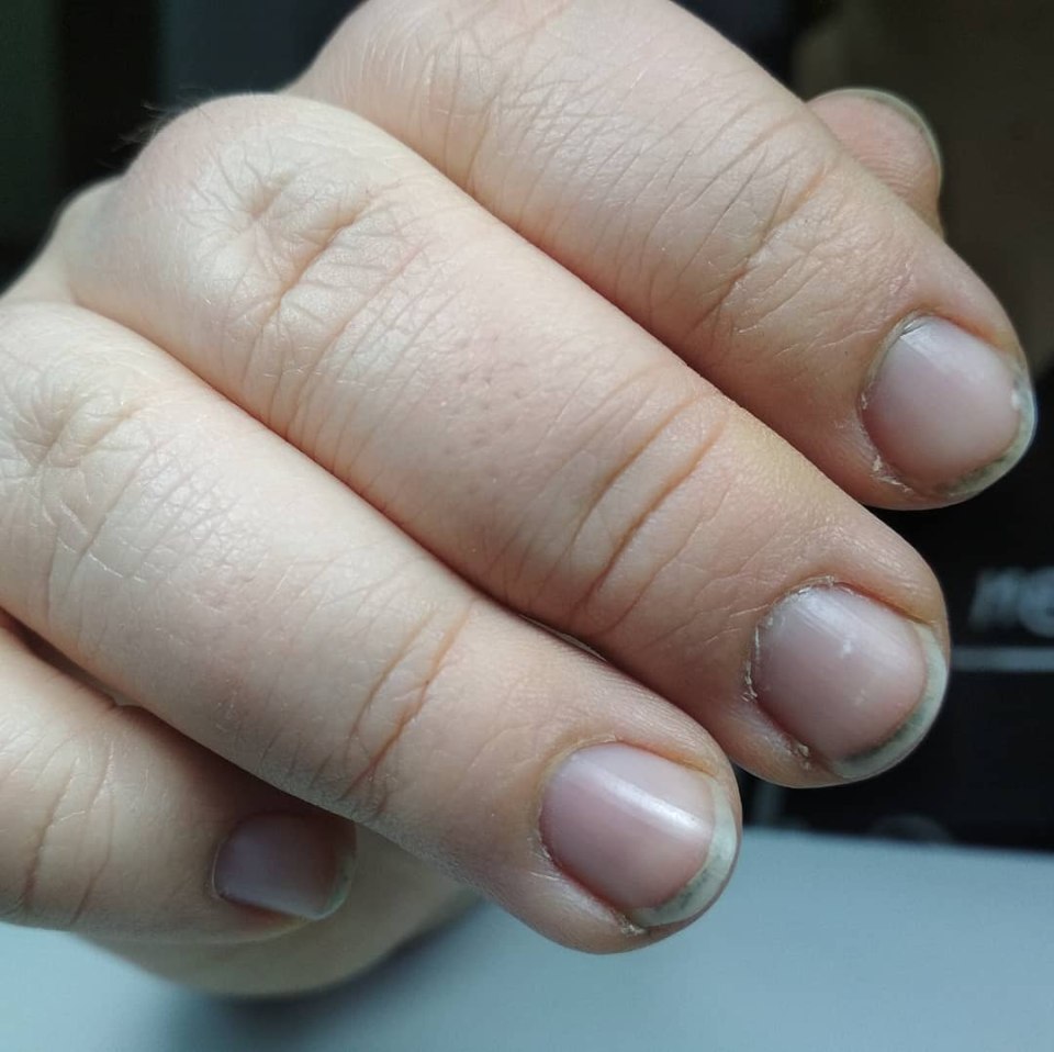 Тигровые ногти