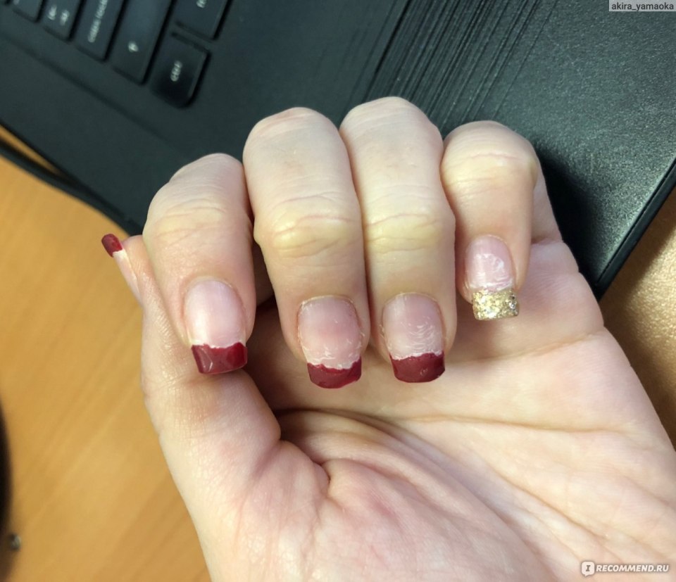 Муха Оленья кровососка