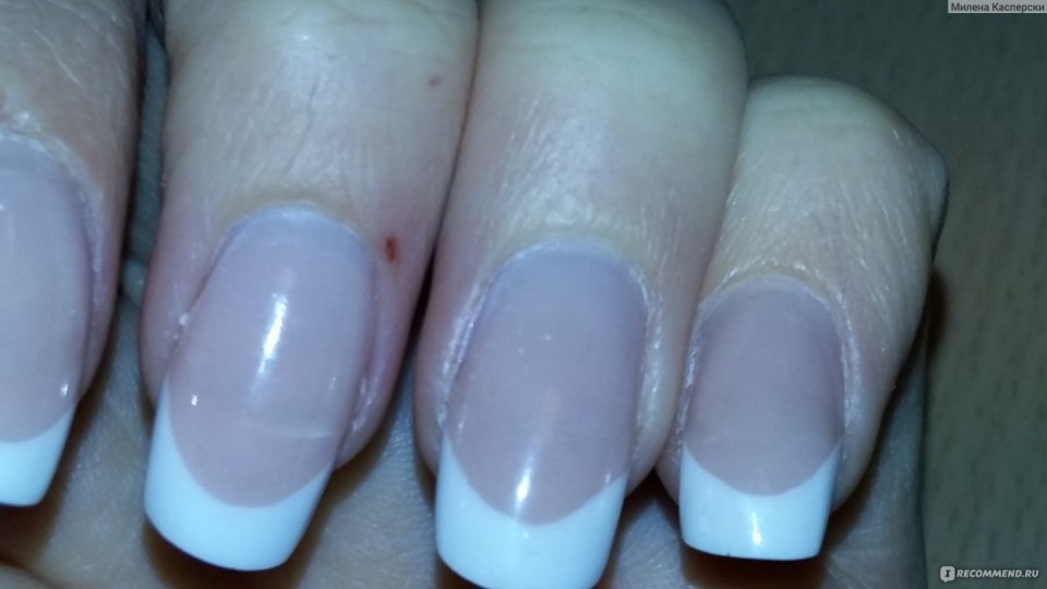 Неудачное наращивание ногтей