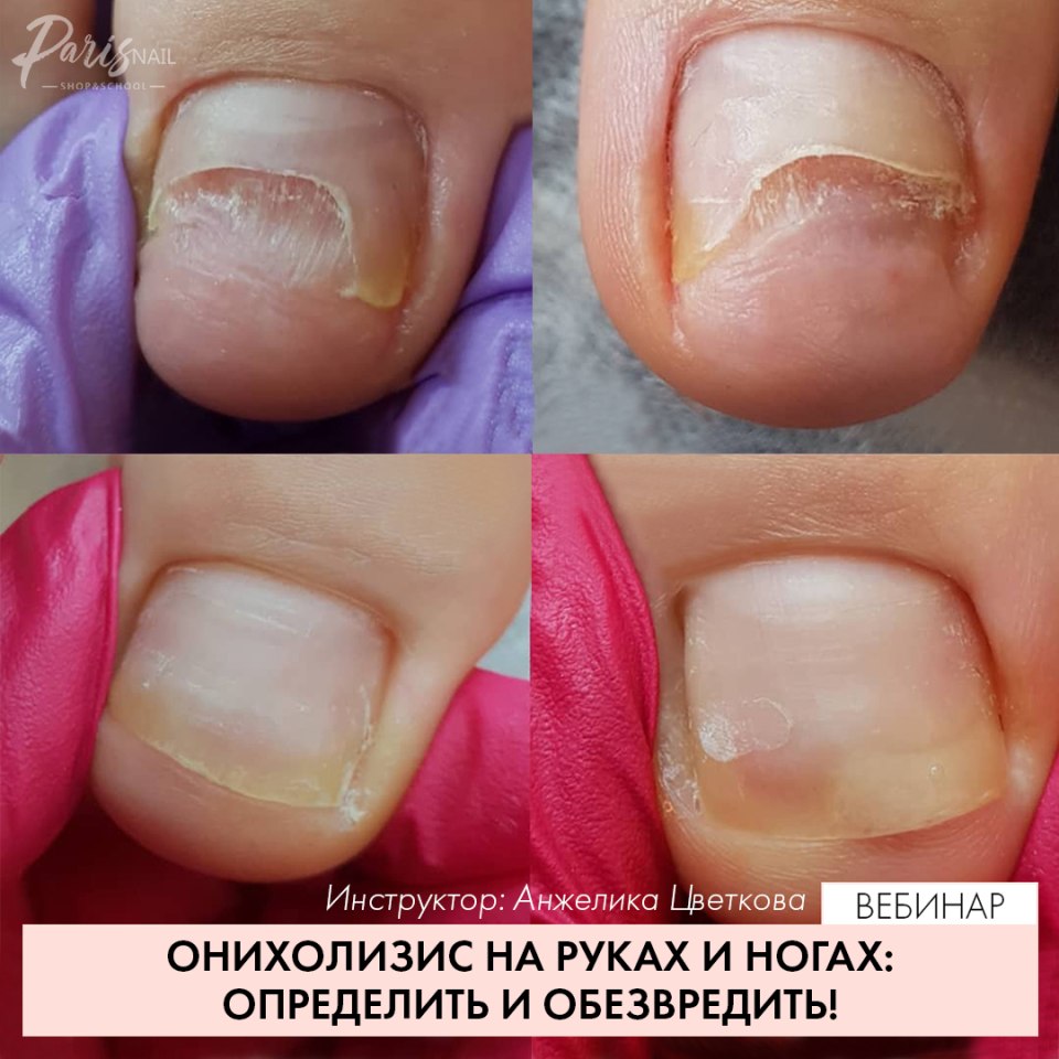 Желтый френч