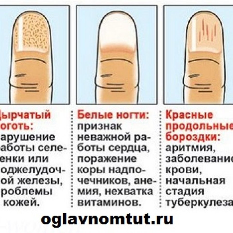 Библиотека здоровья предоставлено национальной медицинской библиотекой nlm