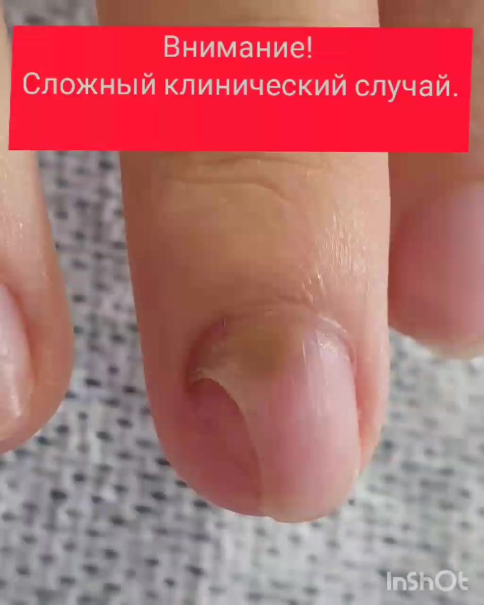 Библиотека здоровья предоставлено национальной медицинской библиотекой nlm