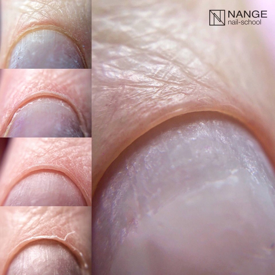 Зубчик чеснока во влагалище