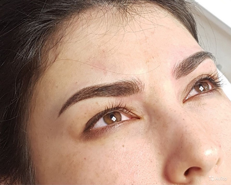 Уменьшить ореолы татуаж