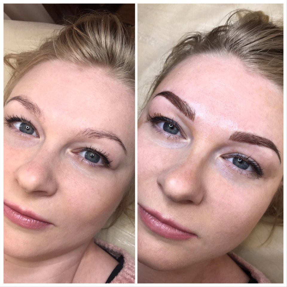 Технологический процесс эпиляции бровей