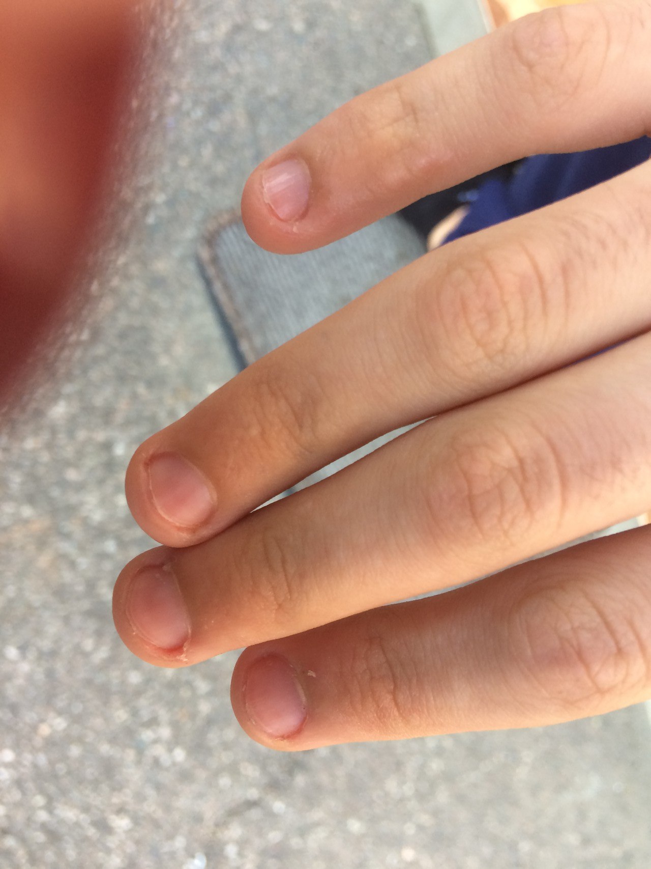 Ногти на маленькие пальцы