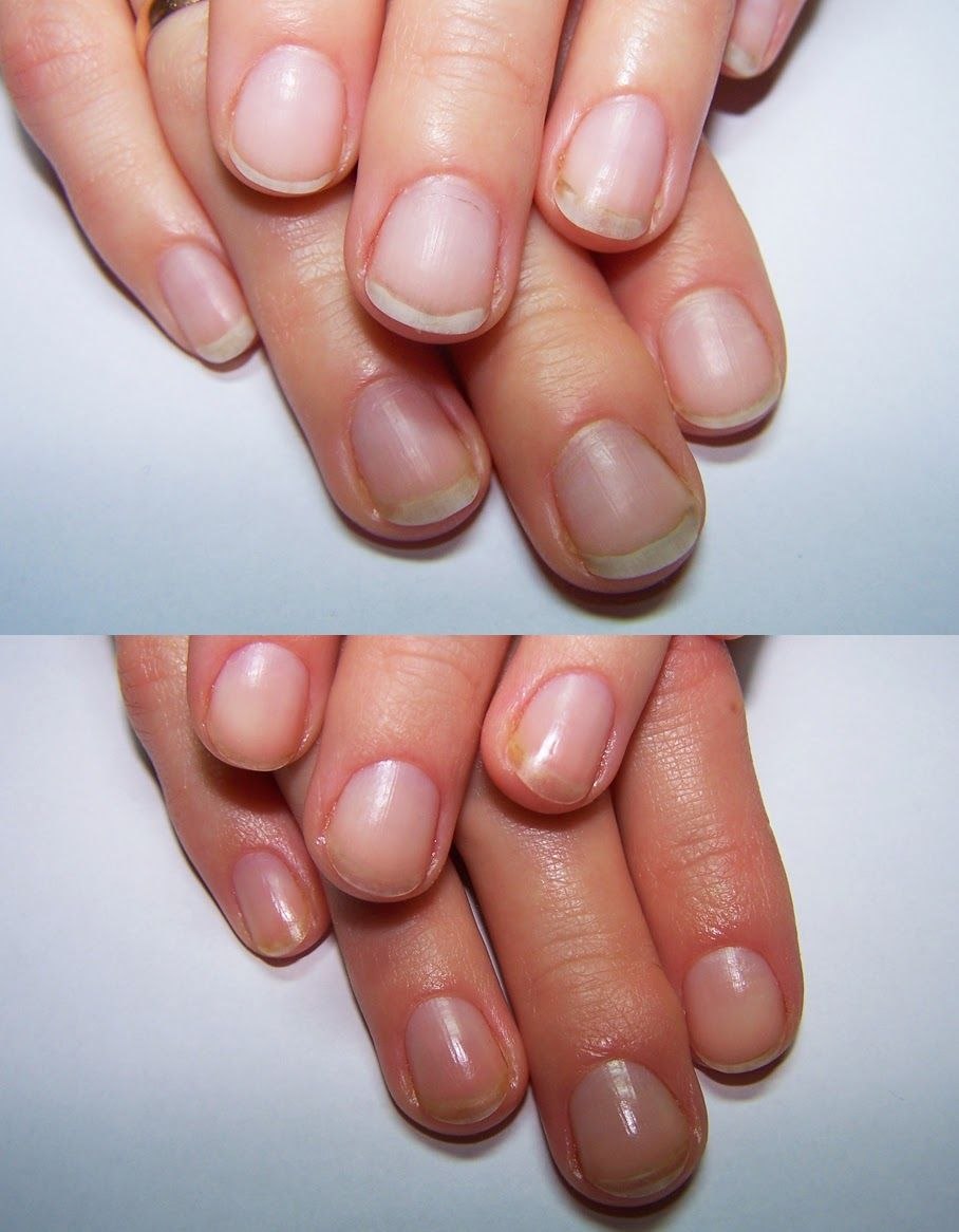 Широкие ногти