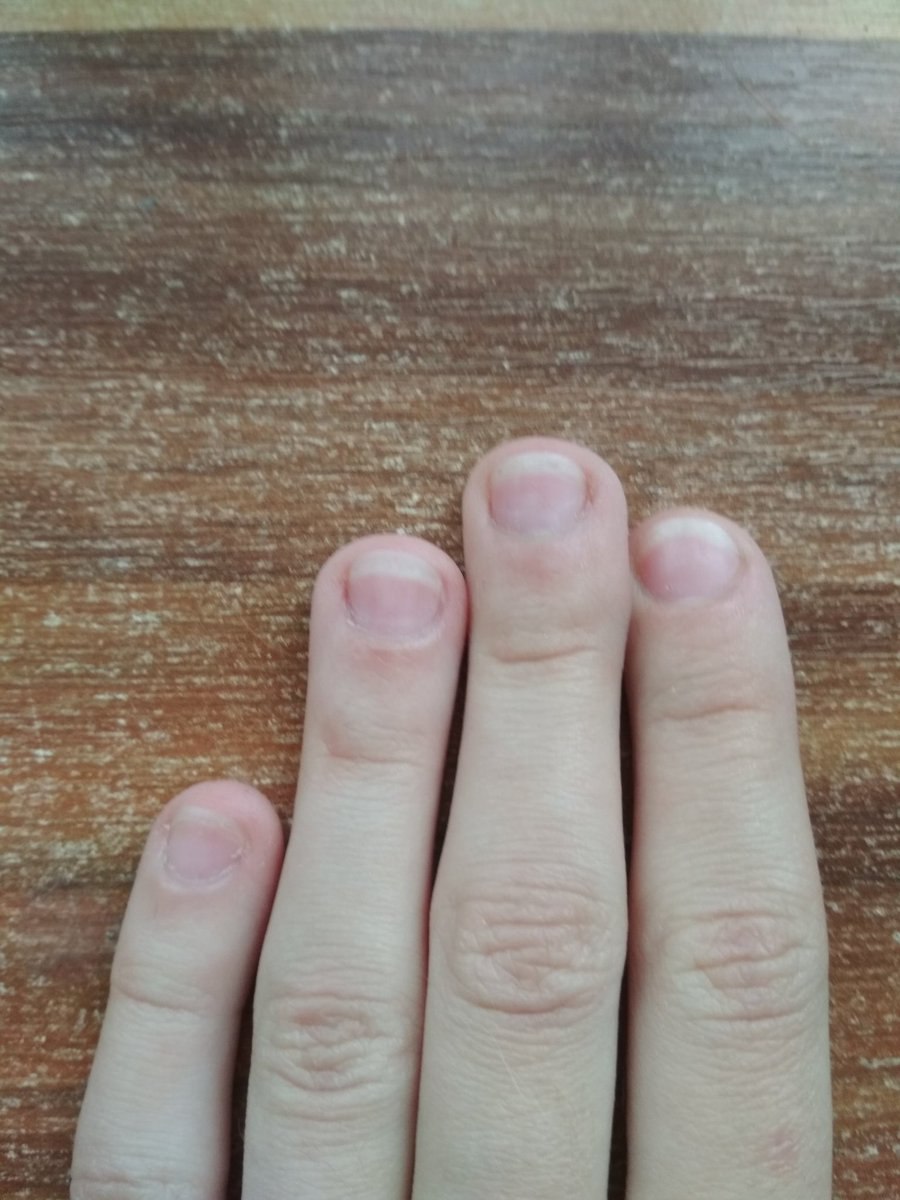 Узкая ногтевая пластина