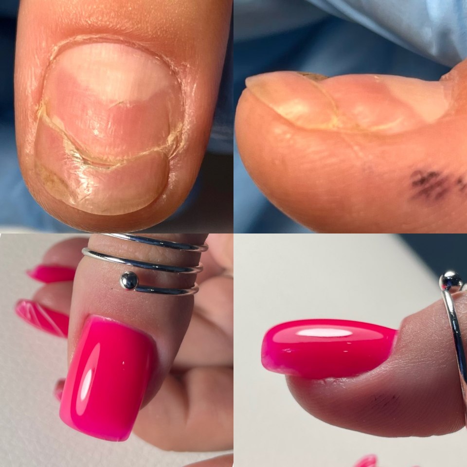 Строение ногтя и ногтевой пластины