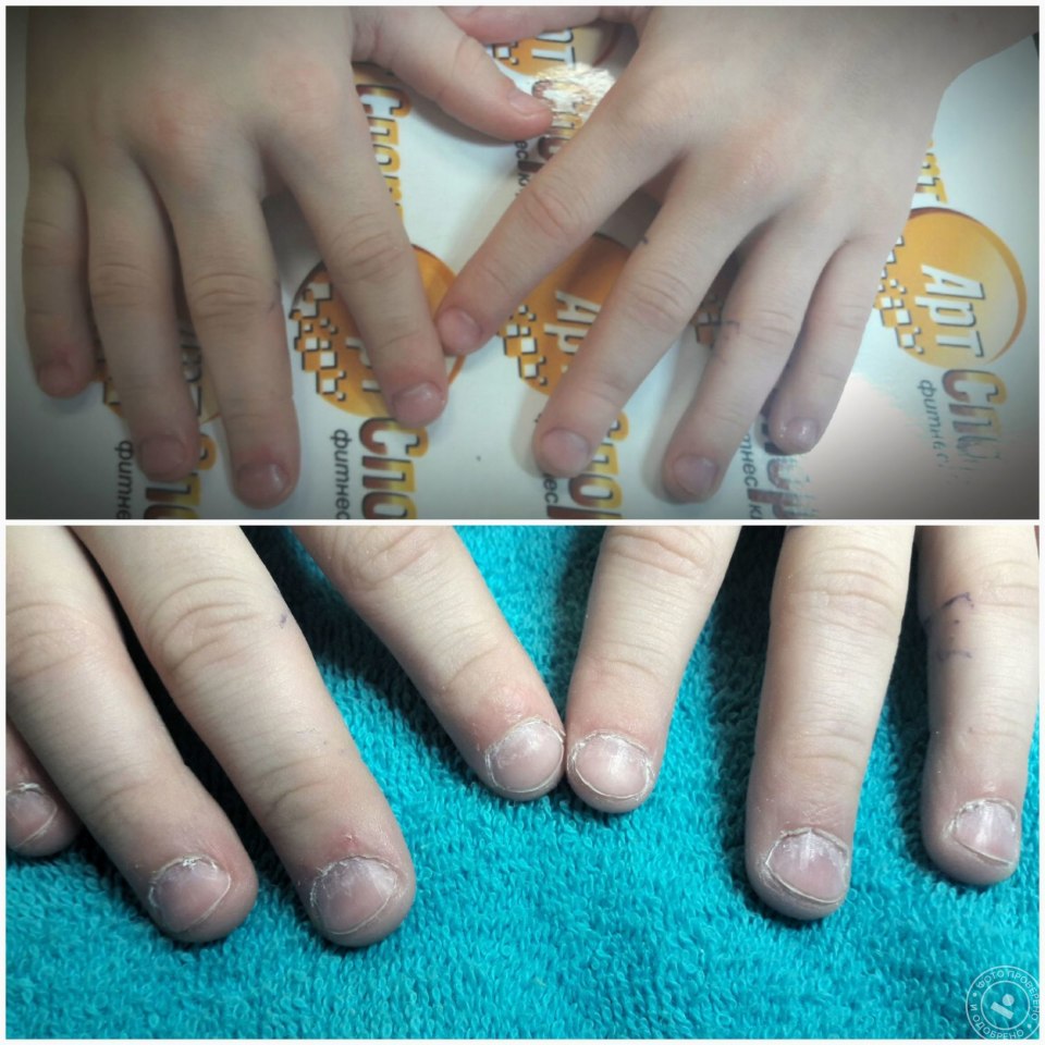 Наращивание для детей