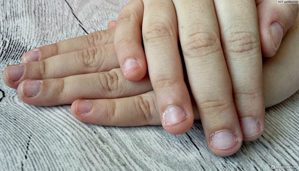 Маникюр на обгрызанные ногти