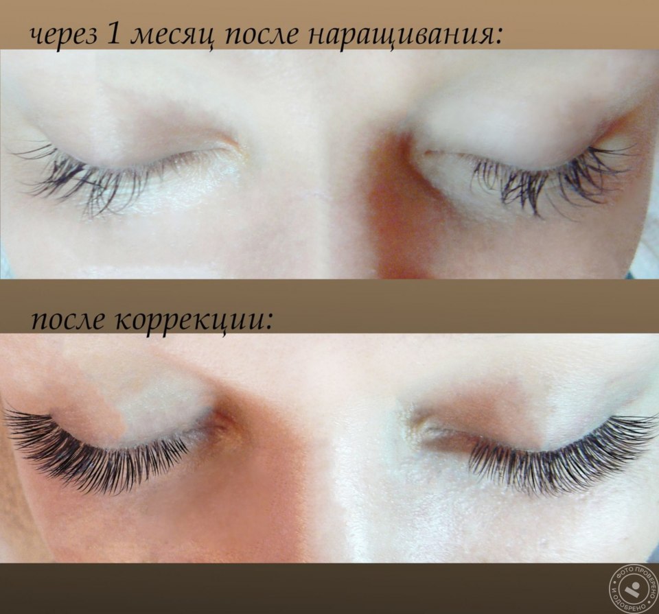 Ботокс ресниц до и после