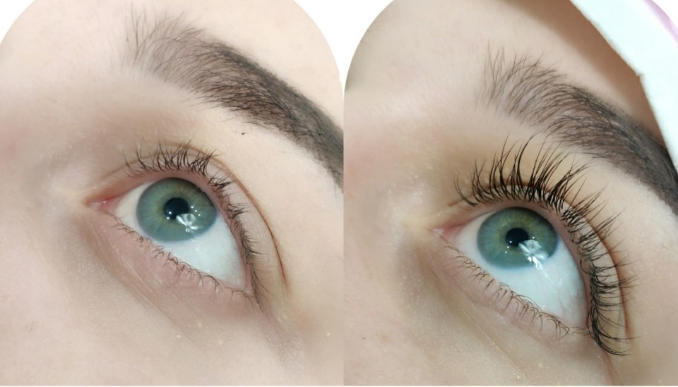 Наращивание классика до и после