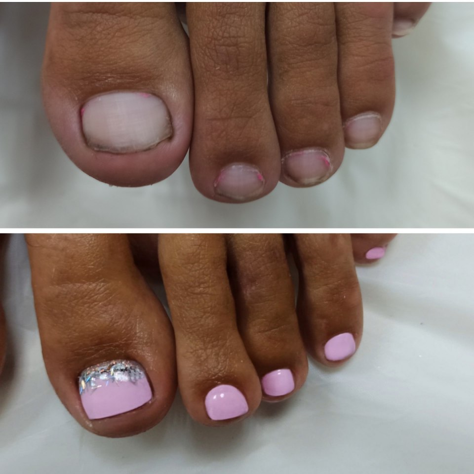 Педикюр молочный с блестками