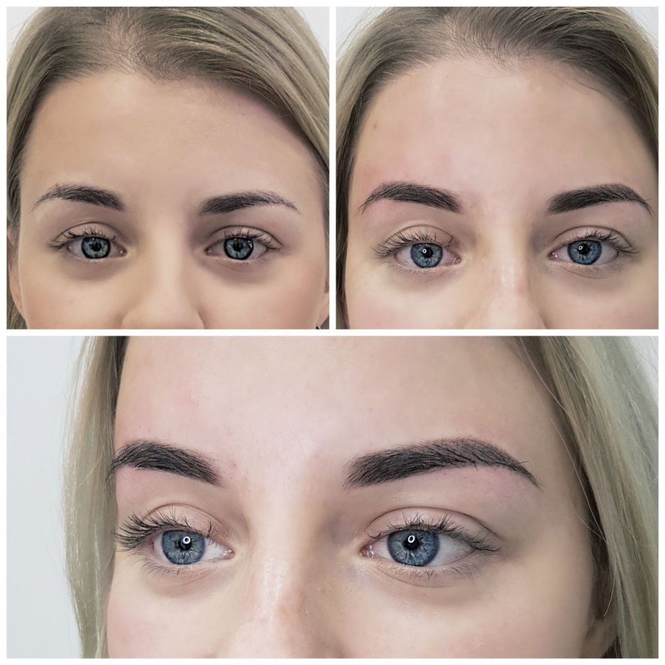 Брови после перманентного макияжа