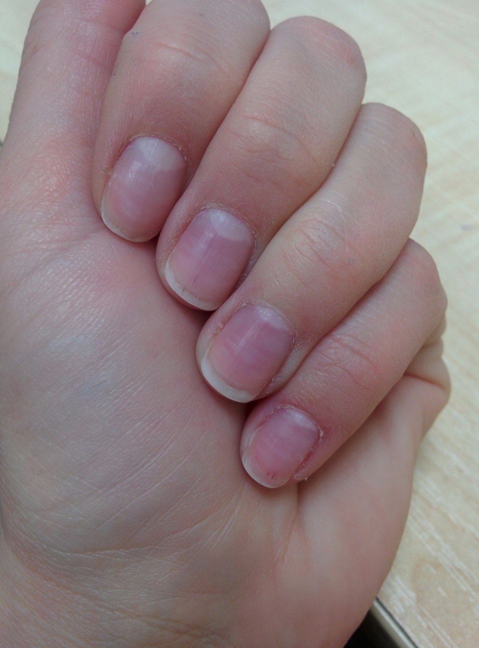 Здоровый цвет ногтей на руках