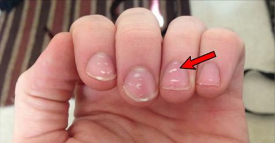 Белье пятнышки на ногтях