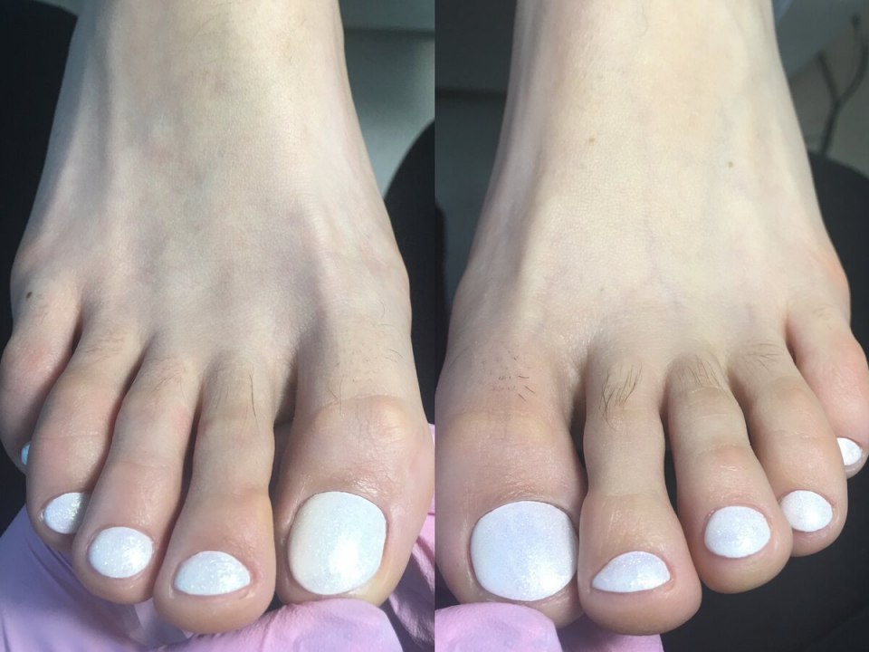 Круглая форма ногтей на ногах