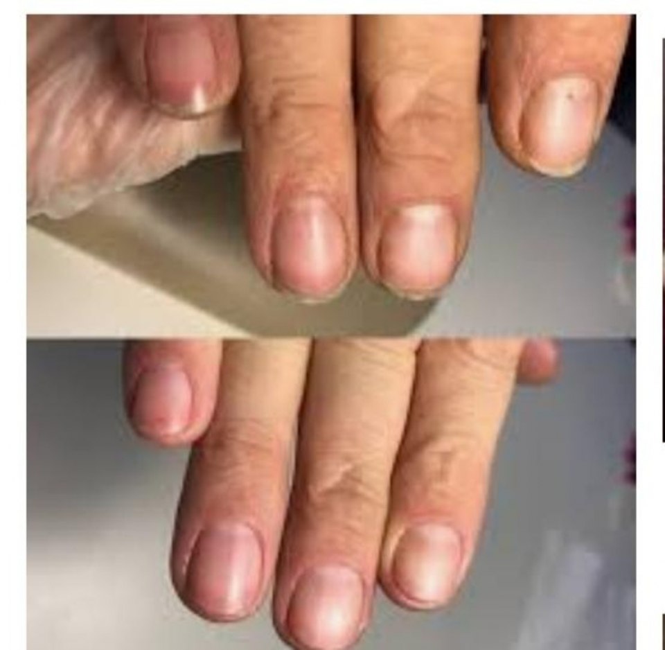 Ногти без маникюра некрасивые