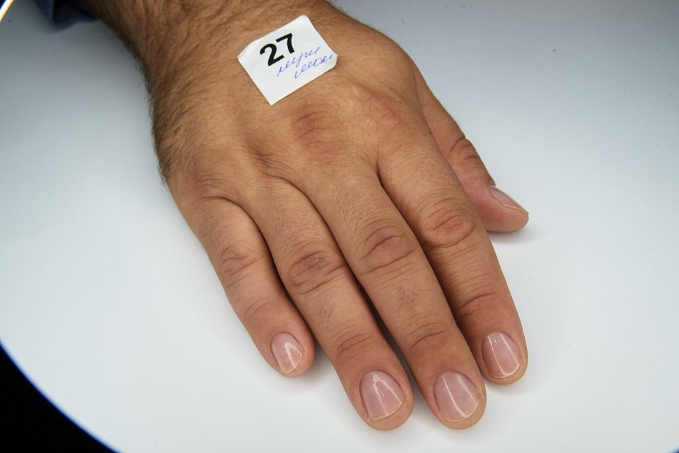 Мужские ногти в ужасном состоянии