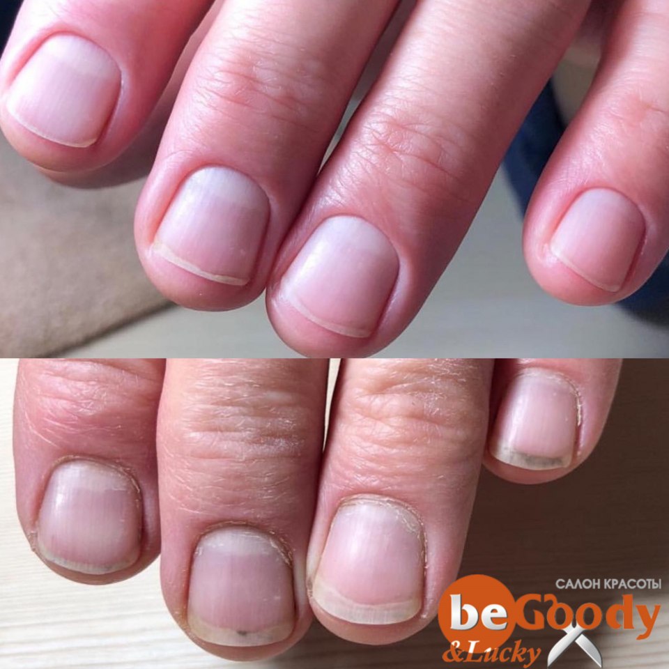 Форма мужских ногтей