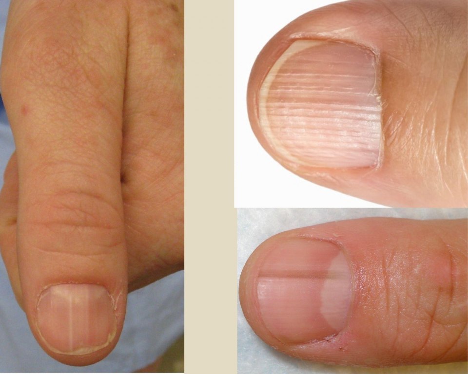 Мужской маникюр