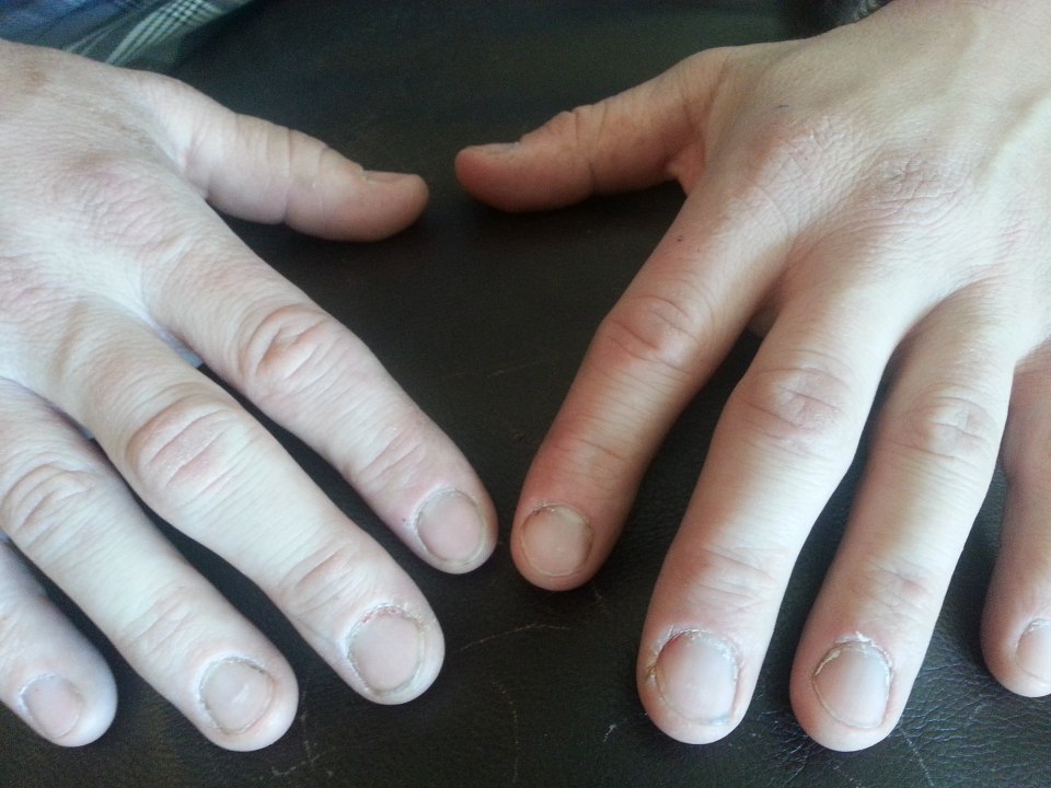 Маникюр до и после