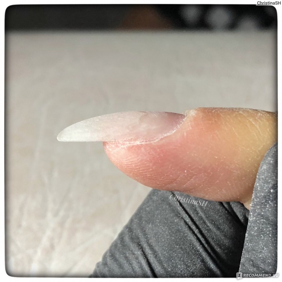 Выравнивание КЛЮЮЩИХ ногтей фото с обратной стороны