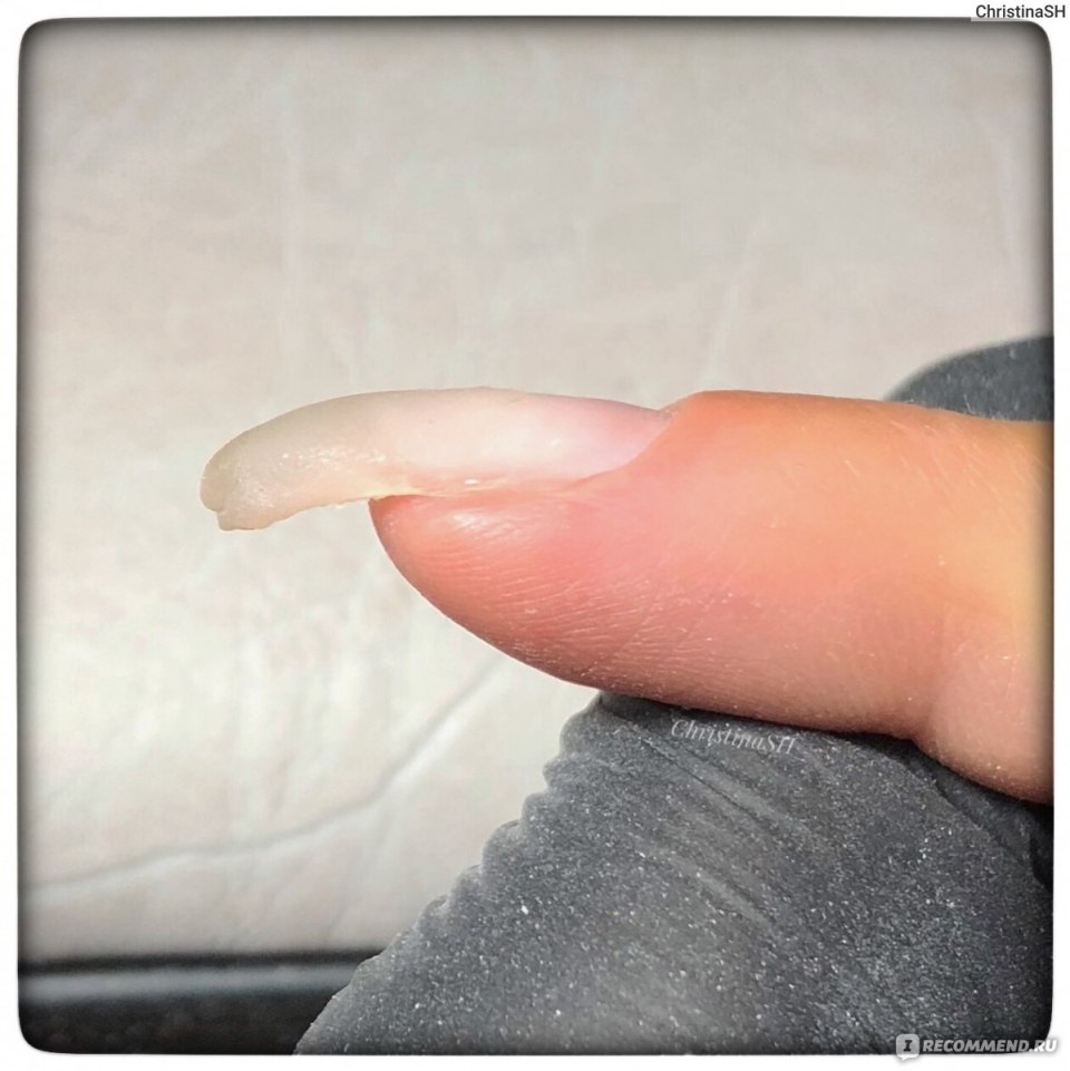 Клюющие ногти