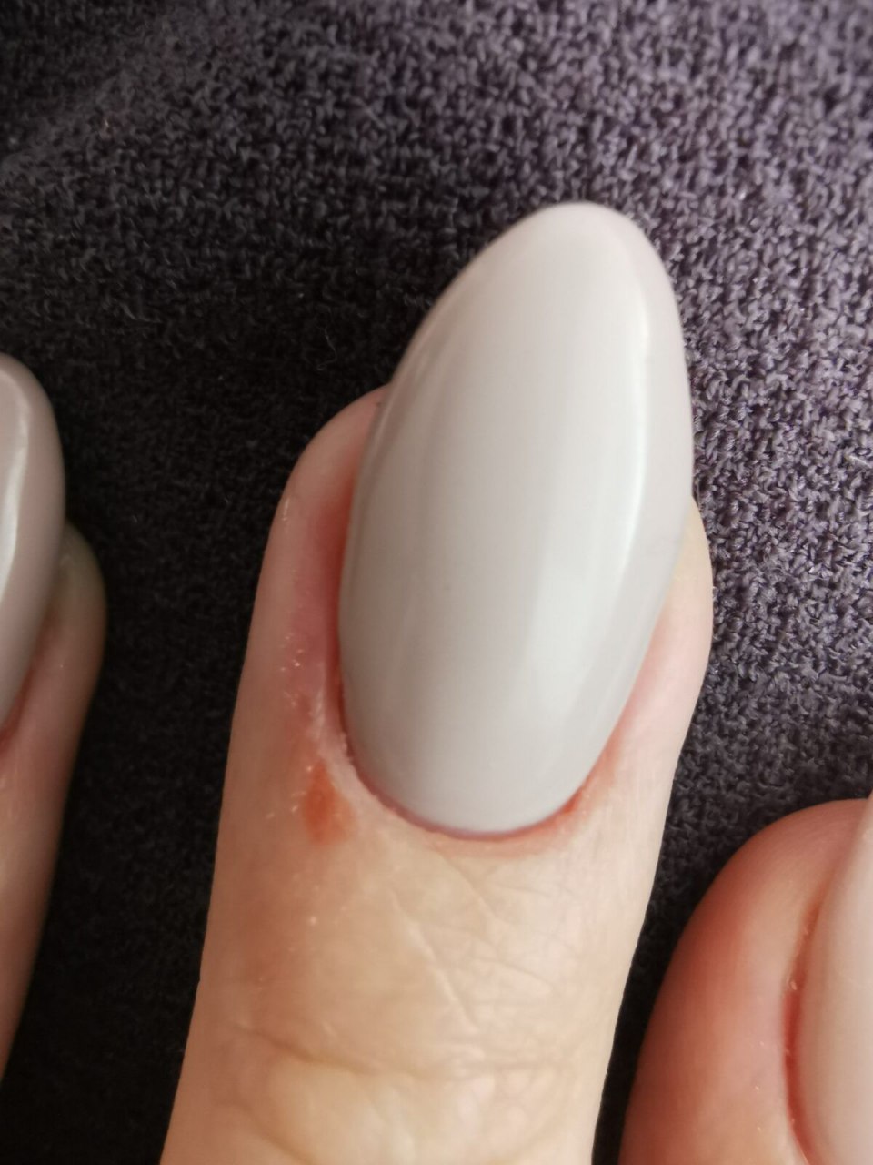 Выравнивание ногтевой пластины