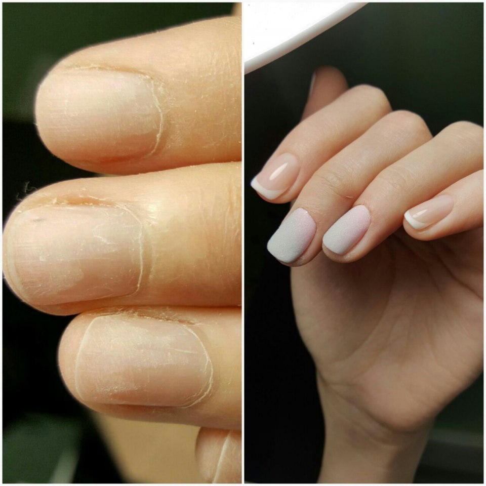 Идеальные ногти