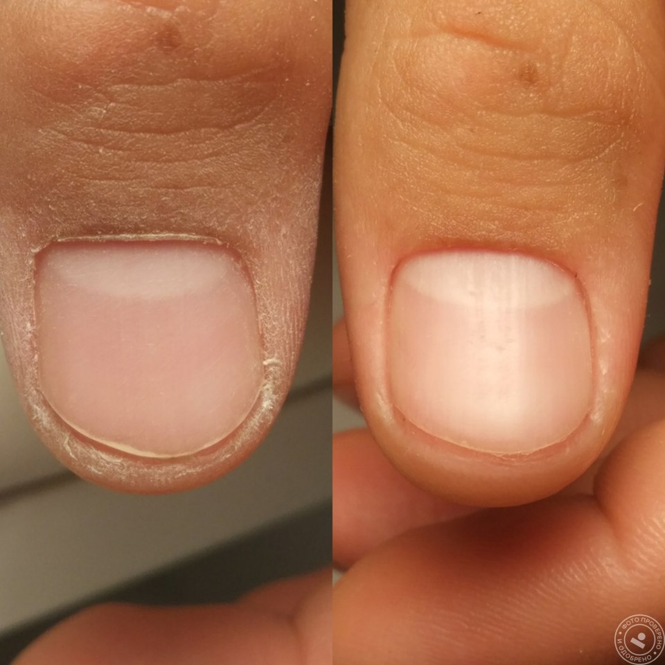 Мужской маникюр до и после