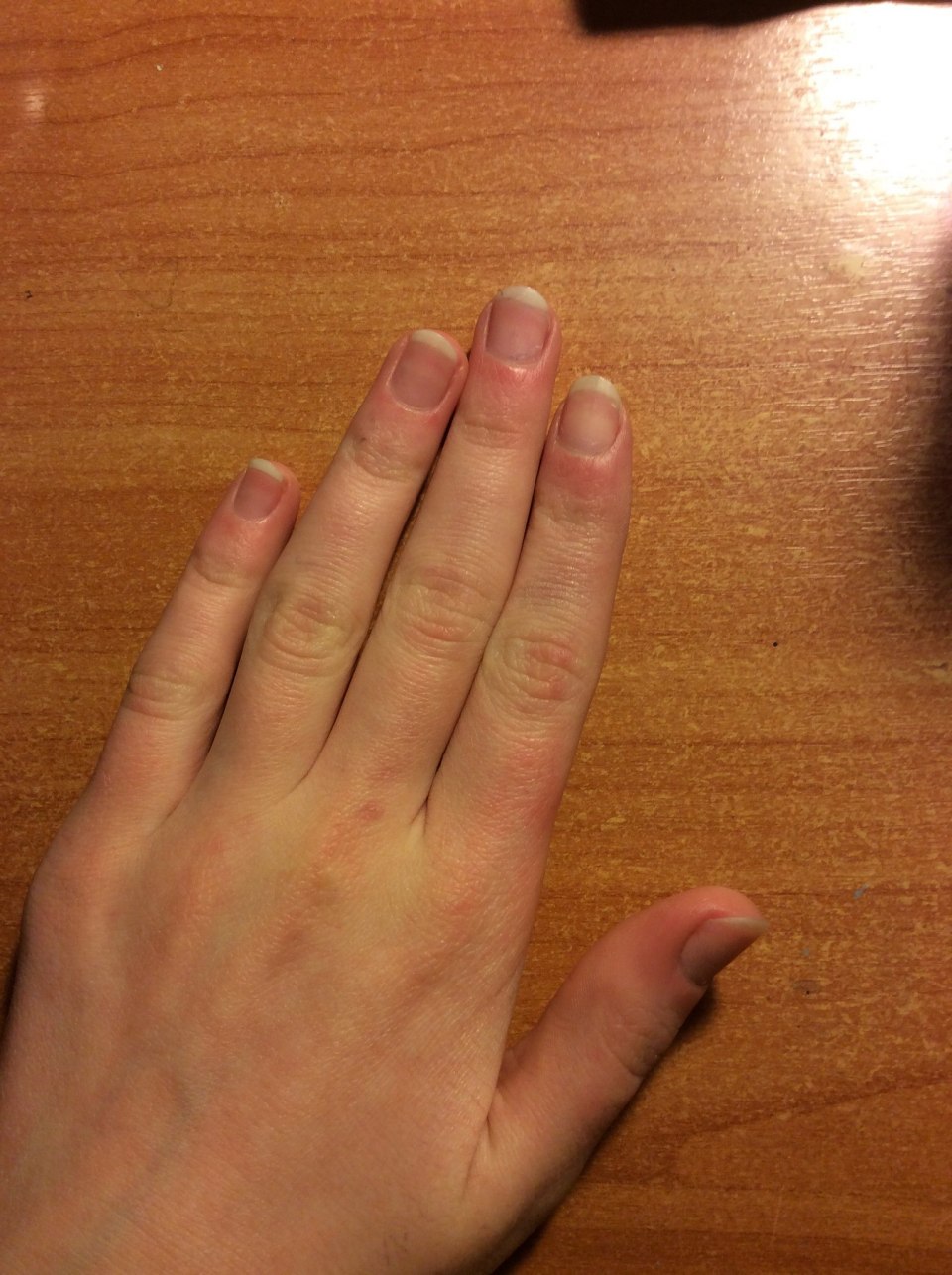 Форма пальцев на руках