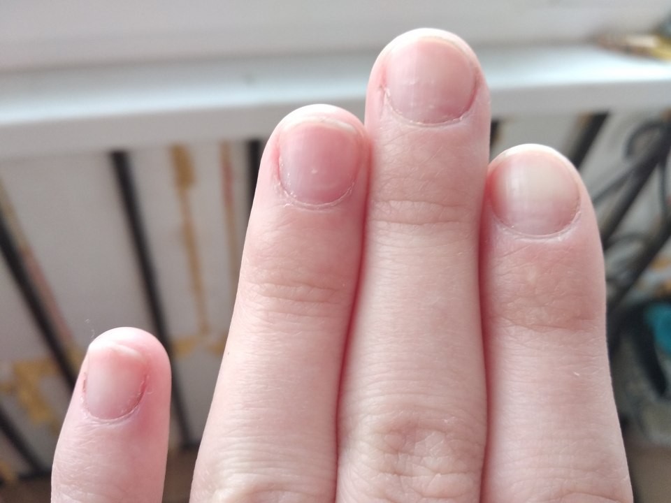 Широкие короткие ногти на руках