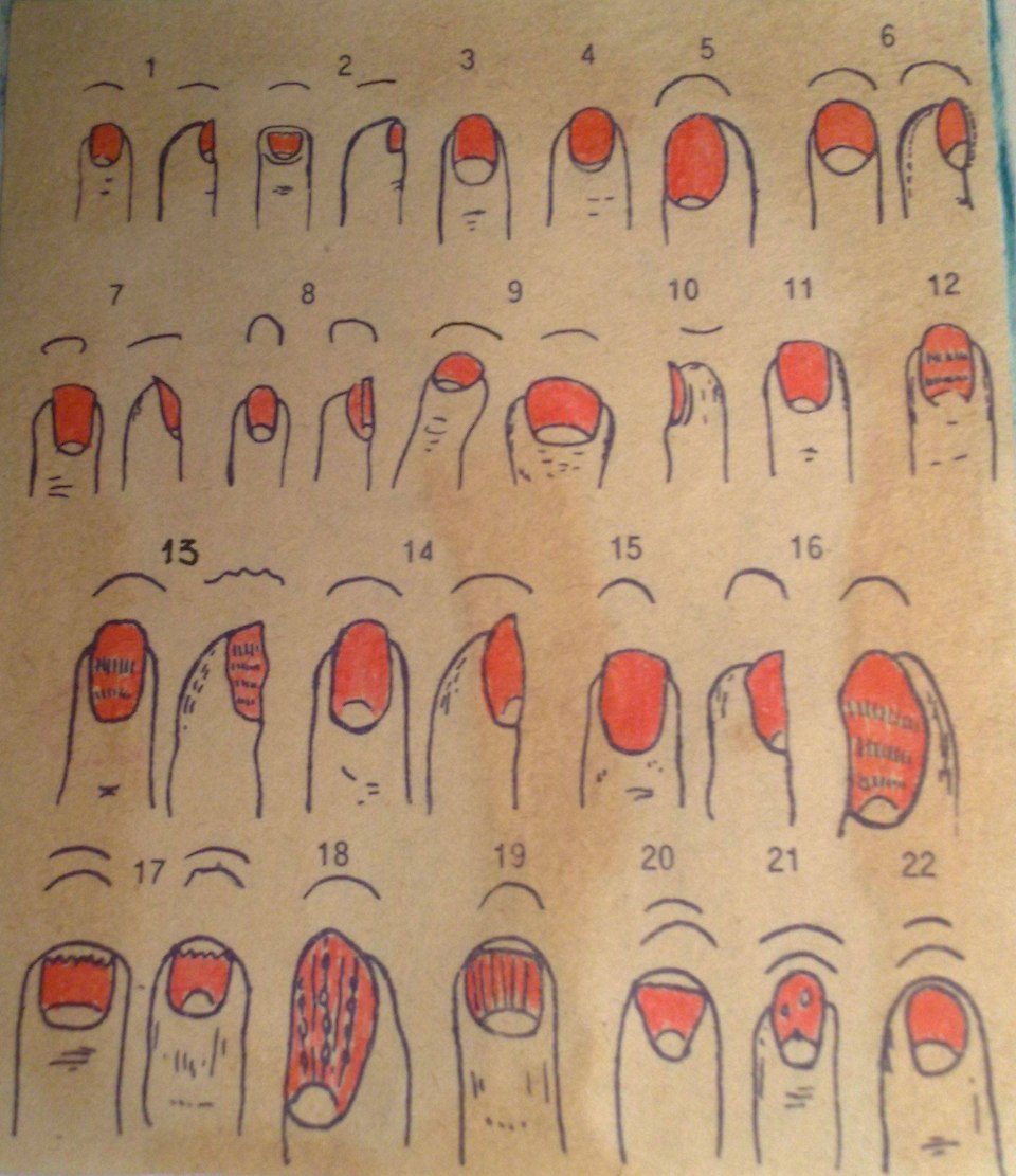 Форма ногтей на пальцах патологии