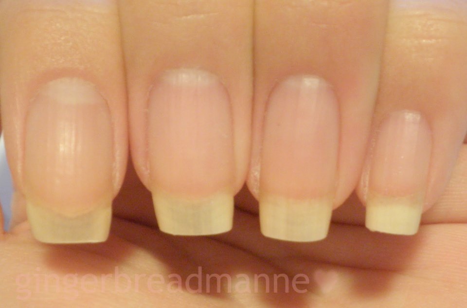 Квадратная форма ногтевой пластины маникюр